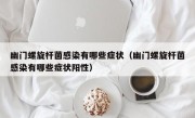 幽门螺旋杆菌感染有哪些症状（幽门螺旋杆菌感染有哪些症状阳性）