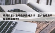 肩周炎怎么治疗最快最好方法（怎么治疗肩周炎最快最有效）