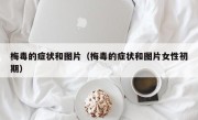 梅毒的症状和图片（梅毒的症状和图片女性初期）